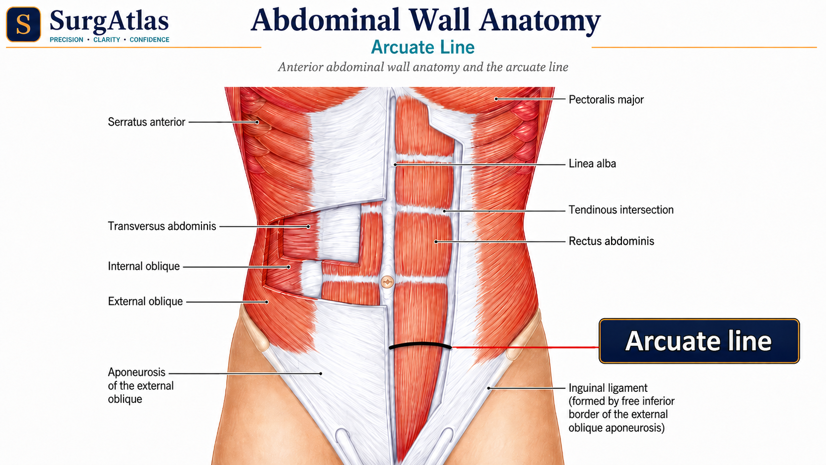 Anterior Abdominal Wall and Rectus Sheath Anatomy SurgAtlas anatomical illustration of the anterior abdominal wall showing rectus abdominis, linea alba, flat abdominal muscles, rectus sheath and arcuate line.