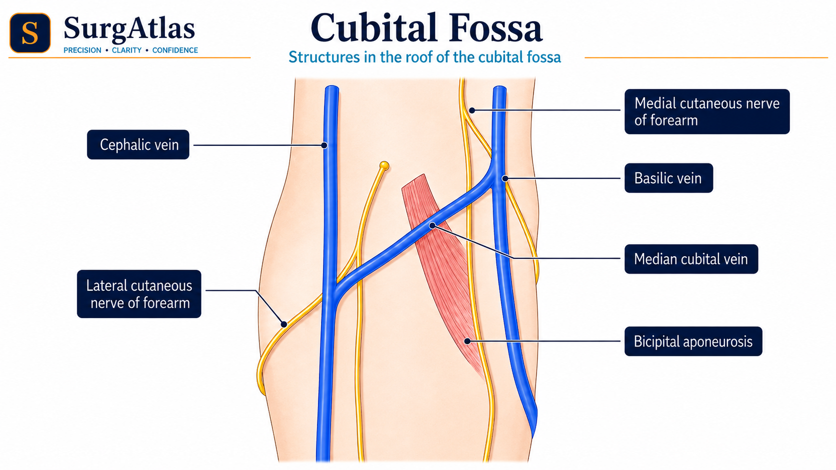 Cubital Fossa Boundaries and Contents SurgAtlas anatomical guide to the cubital fossa showing its boundaries and the radial nerve, biceps tendon, brachial artery and median nerve.